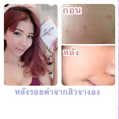 สบู่ล้างหน้าสมุนไพรชาร์ล็อต (Charlotte By POIRATA)
