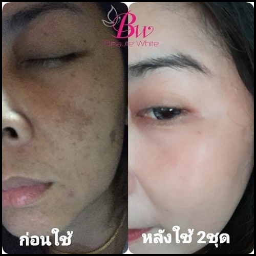 บูเต้ไวท์ เวชสำอางค์ BW Beaute White เซ็ตเล็ก