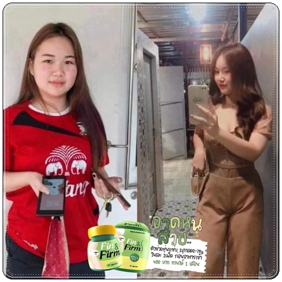 Need U ยูนีด The Richs (Finn&Fin Plus ฟินแอนด์เฟิร์ม แพ็คเกตใหม่)