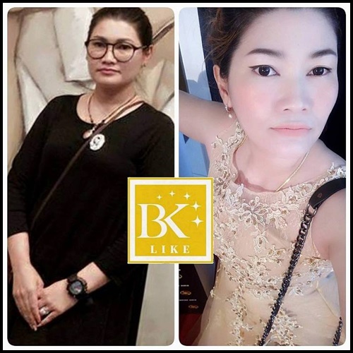 บีเคไลค์ อาหารเสริมลดน้ำหนัก BK Like โปรส่งฟรี