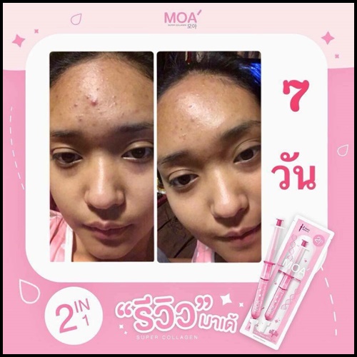 มาเด้เซรั่ม หน้าใส MOA