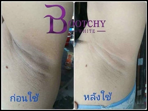 บูทชี่ไวท์ Bootchy White แพ็คเกตใหม่