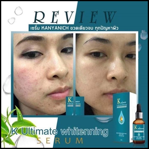 Kanyanich K Ultimate whitening Serum เซรั่มหน้าเด็ก สูตรดร.