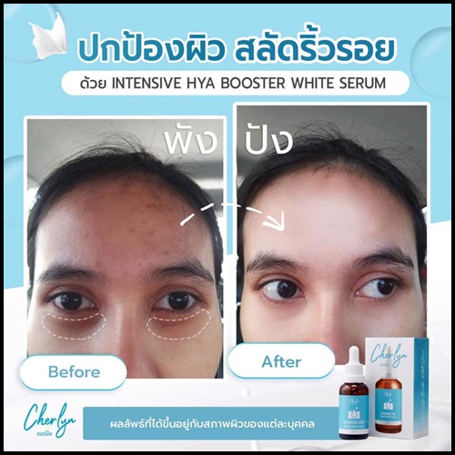 เซรั่มเฌอร์ลิน Cherlyn HYA Serum ของแท้
