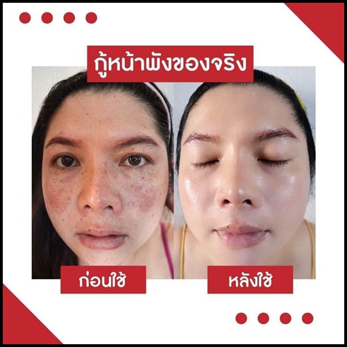 เซรั่มไฮยาดา Hyada Go-VC Vitamin Hyaluronic Acid Serum (1 แถม 1)