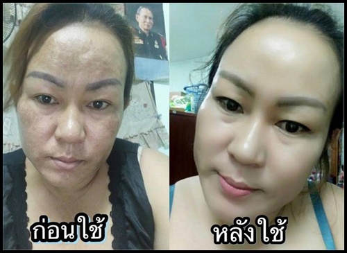 ครีมแก้ฝ้า หน้าใส By Secret white cream