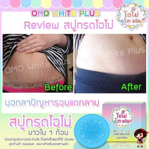 สบู่กรดโอโม่ (OMO White Plus)