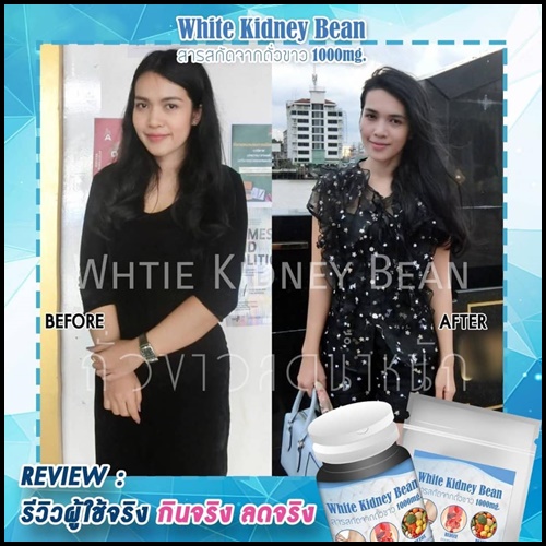 ถั่วขาวลดน้ำหนัก White Kidney Bean