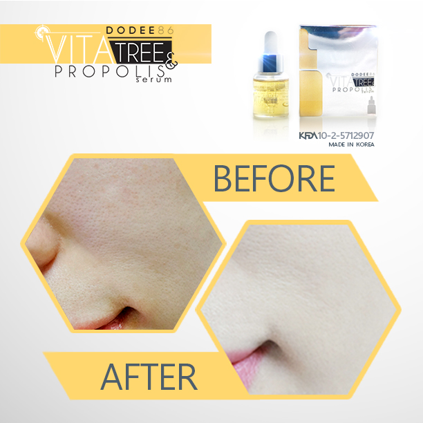 ขาย เซรั่มน้ำลายผึ้ง (Dodee86 Vitatree Propolis)