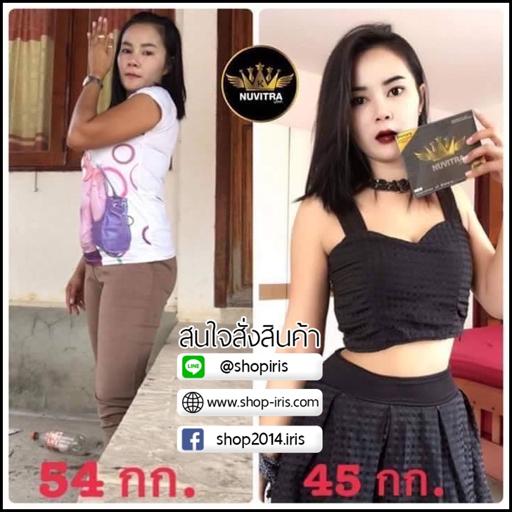 ใหม่ นูวิตร้า เอ็กซ์ NUVITRA X โปรส่งฟรี