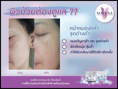 ครีมน้ำแข็ง ไอซ์ เพอร์เฟค ครีม Ice perfect cream By Novena (ครีมกลางวัน)