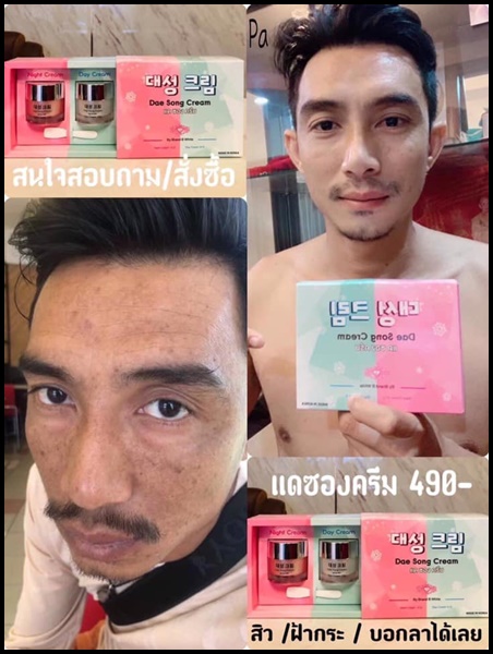 แดซองครีม Dae Song Cream ครีมเกาหลี (โปรส่งฟรี)