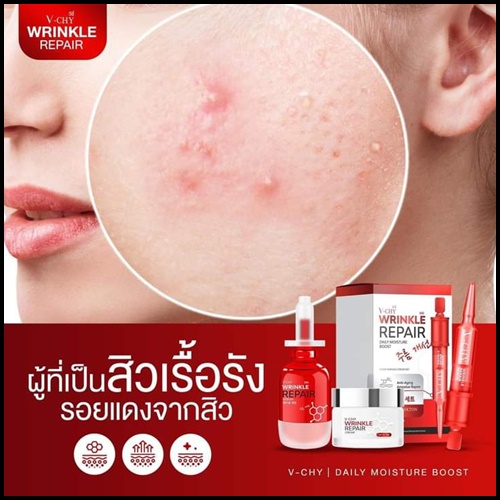 วีชี่ริงเคิล รีแพร์ V-Chy Wrinkle Repair เซรั่มลดริ้วรอย