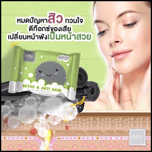 ใหม่ สบู่คลีนซิ่ง ดีท็อกซ์เอมิ Detox & Anti Acne By Ami Skincare
