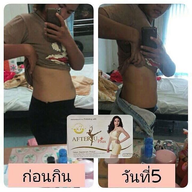 อาหารเสริมลดน้ำหนัก อ๊าฟเตอยู พลัส (After U Plus)