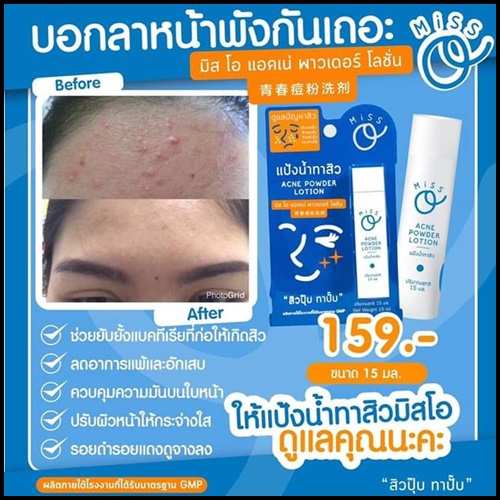 แป้งน้ำทาสิว มิสโอ Miss O Acne Powder Lotion