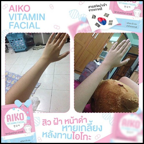 ไอโกะ วิตามินหน้าเงาเกาหลี Aiko Vitamin Facial