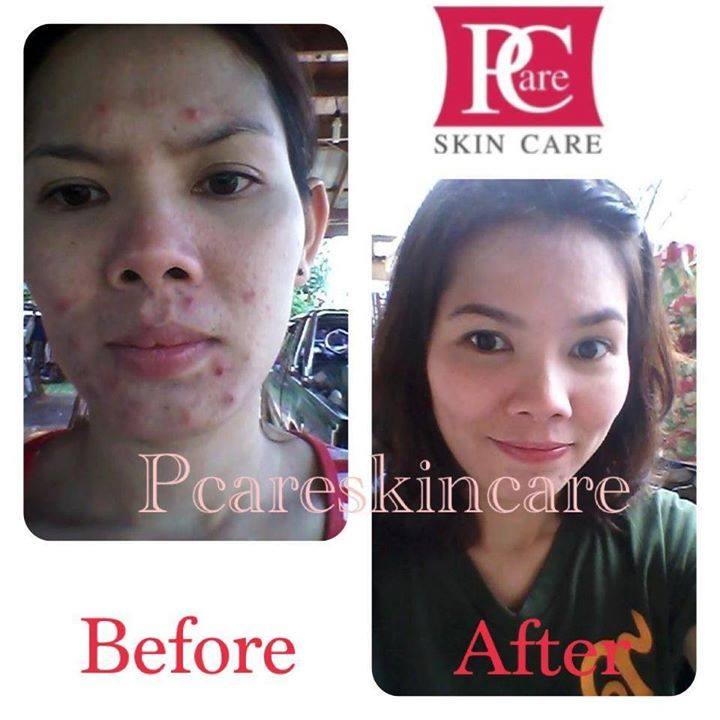 ขาย เซรั่ม ไวท์ บูสเตอร์ ไนท์ Pcare WHITE BOOSTER NIGHT SERUM by Pcare