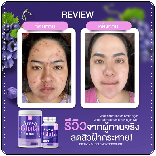 อารยา กลูต้าพลัส ผงชงผิวเผือก Araya Gluta Plus วิตามินผิวเผือก (1แถม1)