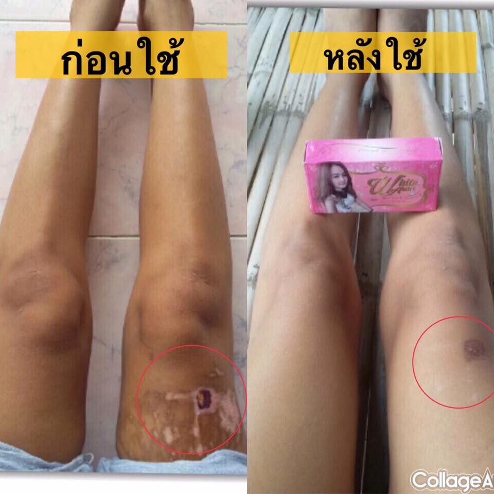สบู่ไวท์ออร่า สารสกัดจากแครอทแท้ (White aura miracle carrot soap) แพ็คเกตใหม่