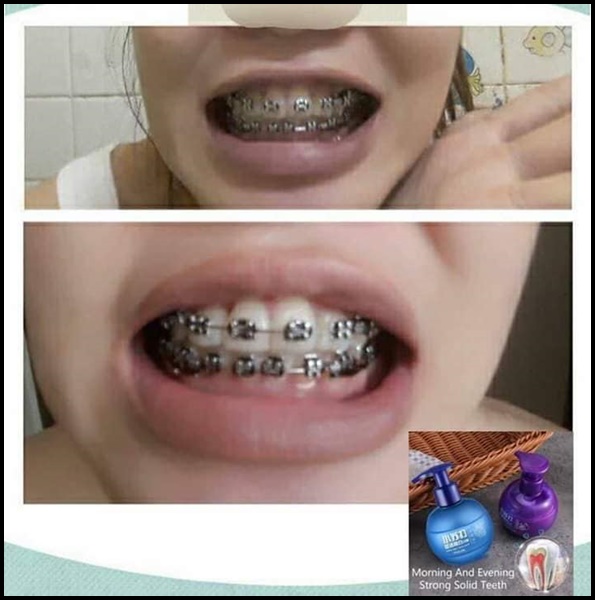 ยาสีฟันแบกกิ้งโซดาเนื้อเจล ยาสีฟันจีน เน้นฟันขาว