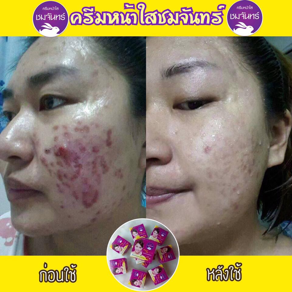 ครีมหน้าใสชมจันทร์ แบบหลอด