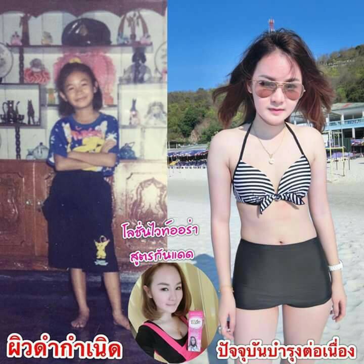 โลชั่นไวท์ออร่า (WhiteAura Whitening Lotion)