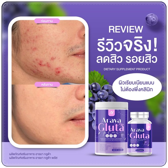 อารยา กลูต้าพลัส ผงชงผิวเผือก Araya Gluta Plus วิตามินผิวเผือก (1แถม1)