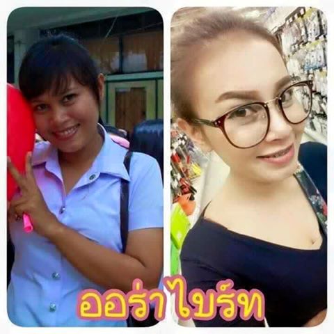 ออร่าไบรท์ ออลิน่า กล่องฟ้า (Aurabright Allina L-Glutathione & Co-Q10) โฉมใหม่