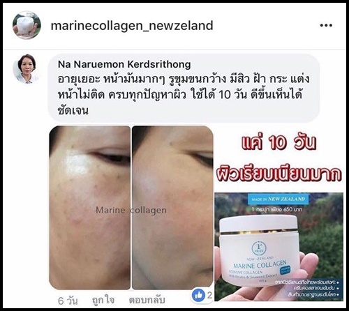 มารีน คอลลาเจน จากนิวซีแลนด์ Marine Collagen