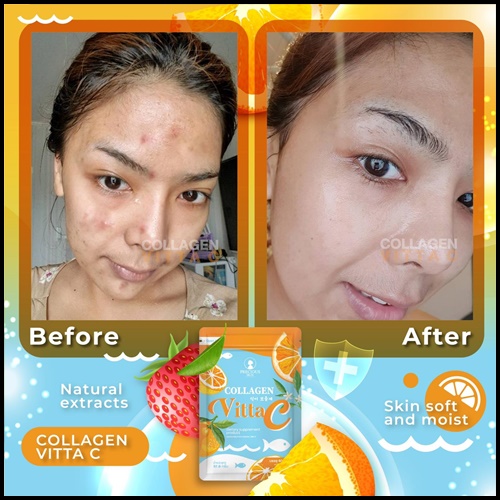 Collagen VittaC BY Precious Skin