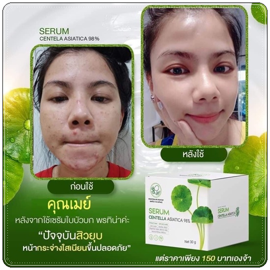 เซรั่มใบบัวบก ผสมว่านหางจระเข้ Serum Centella Asiatica Pontina