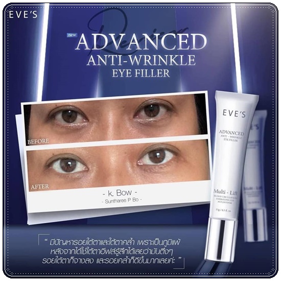 EVE'S Advanced Anti-Wrinkle Eye Filler ผลิตภัณฑ์บำรุงผิวรอบดวงตา (ส่งฟรี)