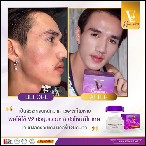 ครีมวีทู V2 REVOLUTION WONDER NIGHT REPAIR สูตรใหม่