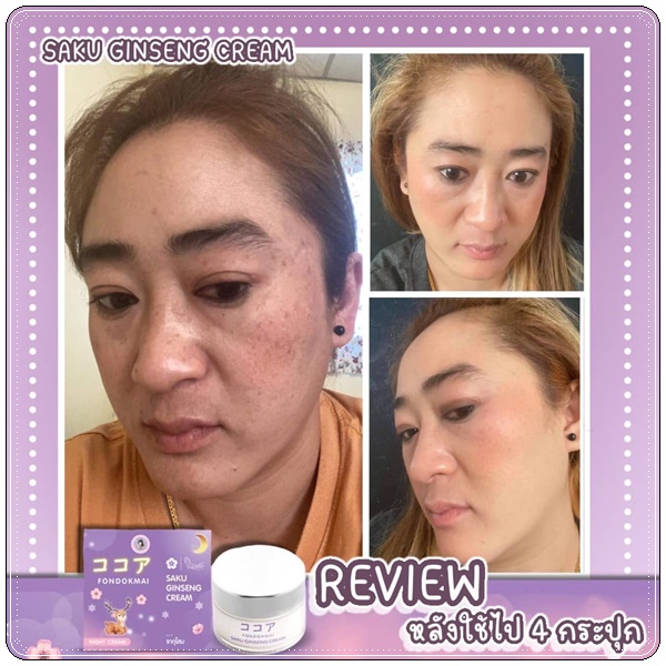 ซากุโสม Saku Ginseng Cream By Fondokmai