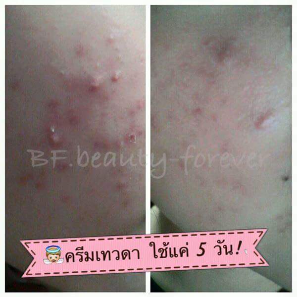 ครีมเทวดา (Plus Whitening)