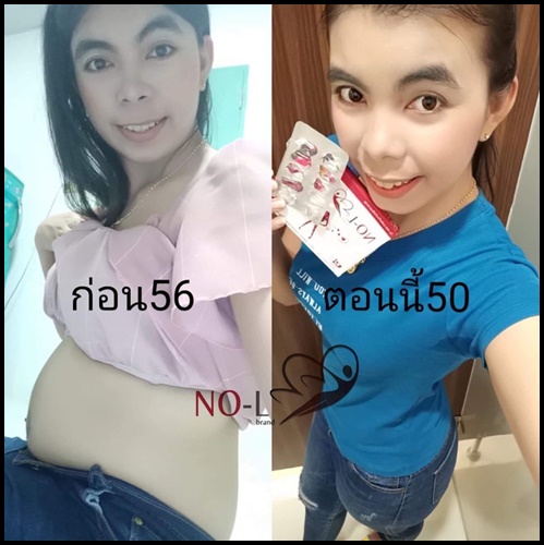 NO-L brand โน-แอล ผลิตภัณฑ์เสริมอาหาร