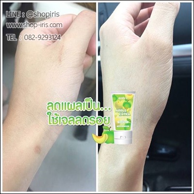 ครีมลดรอยแผลเป็น แอปเปิ้ล เอ็กซ์ตร้า apple extra by Evaly’s