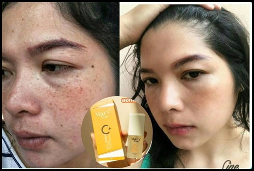 เซรั่มวิตซี สลายฝ้า มารีแอน Mary Ann (โปรส่งฟรี)