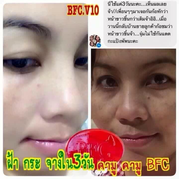 สบู่คามู คามู (สบู่หน้าเงา ลดฝ้า กระ) Camu White Soap by BFC