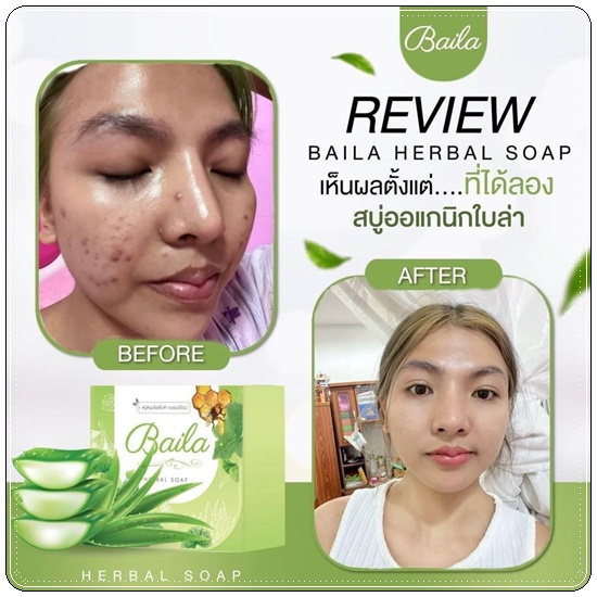 สบู่ใบล่า Baila Herbal Soap DAIME