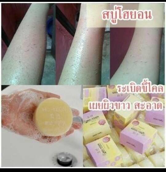 สบู่โฮยอน ระเบิดขี้ไคล ขาวออร่า (Ho-Yeon)