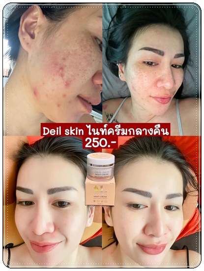 Deli Skin Night Cream ไนท์ครีมบำรุงผิวหน้า