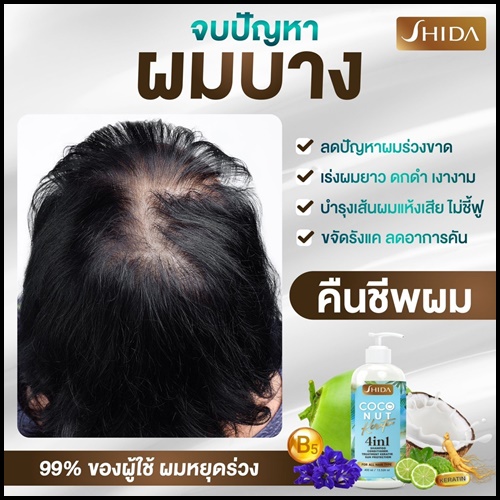 แชมพูชิดะ โคโค่นัท เคลาติน SHIDA Coconut Keratin 4in1 (โปร1แถม1)