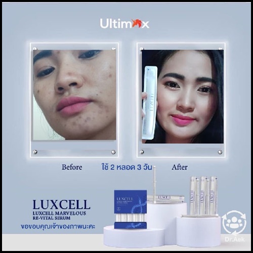 เซรั่มหน้าเด็ก Luxcell คุณภาพระดับสเต็มเซลล์ ของแท้
