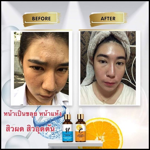 เซรั่มวิตามินซี Anti Aging Vitamin C Serum