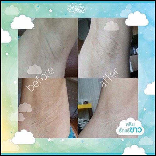 ครีมรักแร้ขาว ไวท์อัพอาร์มพิท White up armpits by Cherrlyn