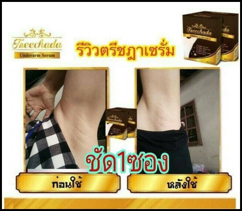 เซรั่มรักแร้ ตรีชฎา Treechada Underarm Serum
