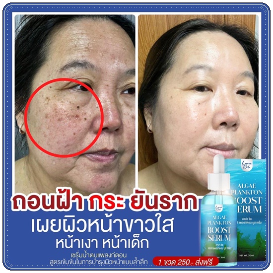 เซรั่มน้ำตบแพลงก์ตอน Algae Plankton Boost Serum LANA Rich (ส่งฟรี)