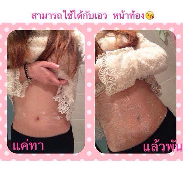 ครีมกระชับสัดส่วน Mori rosen